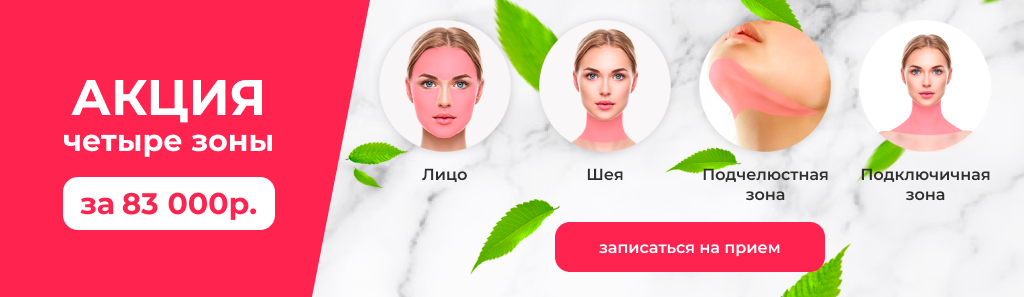 зоны смас лифтинга